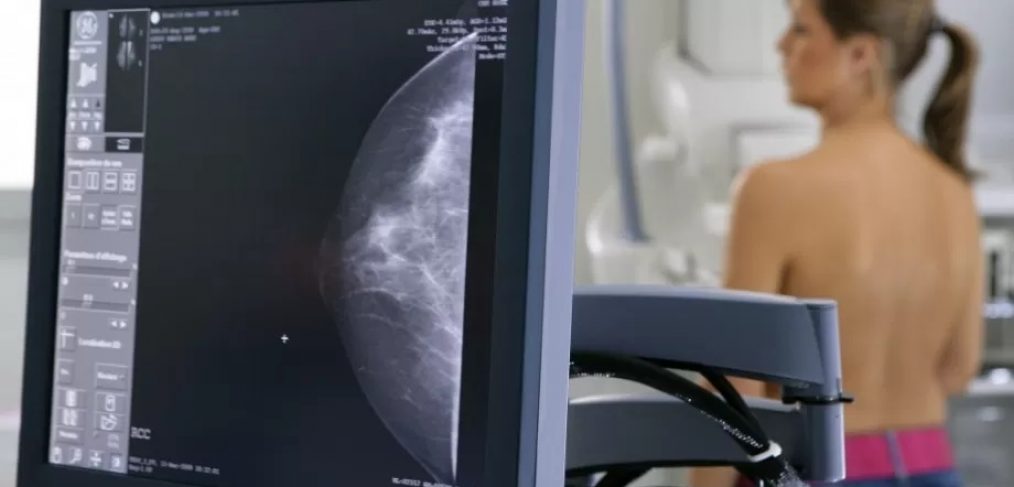 Ce trebuie sa stim despre mamografie?